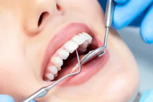 Why You Shouldn’t Skip Your Regular Dental Exams