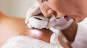 Discussing The Role of Dermatology in Early Skin Cancer Detection
